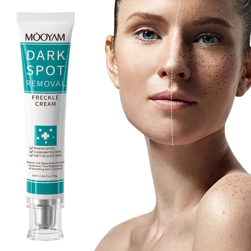 dark spot removal cream whitening freckle cream
