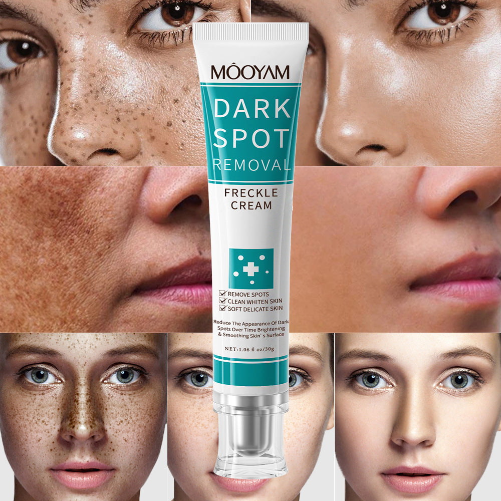 dark spot removal cream whitening freckle cream