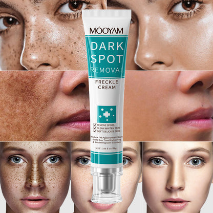 dark spot removal cream whitening freckle cream