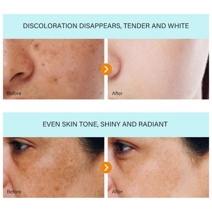 dark spot removal cream whitening freckle cream